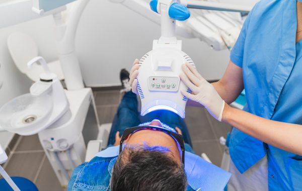 In Chair Tooth Whitening