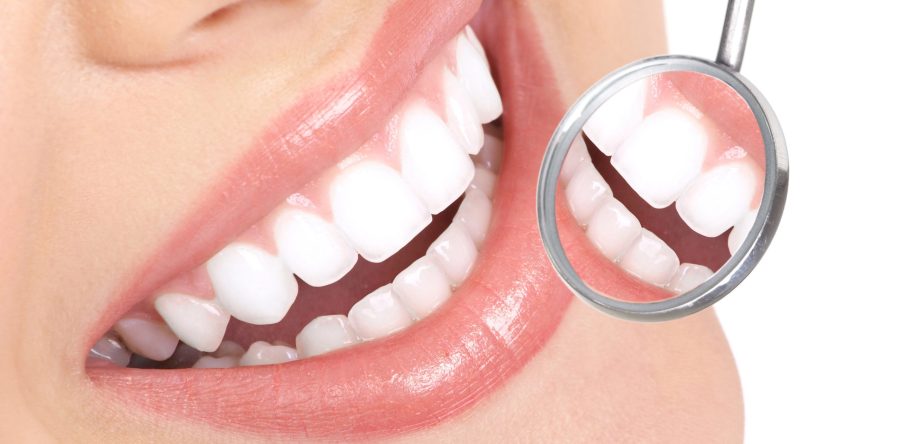 Teeth Whitening & dental implants